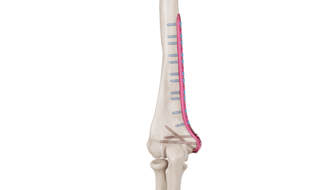 Distal Humerus Medyal Plak