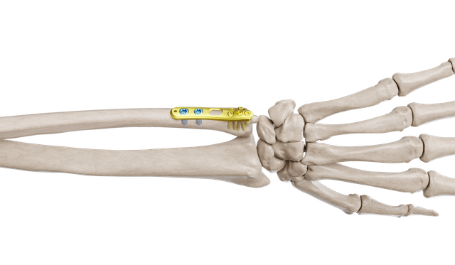 Distal Ulna Anatomik Plak