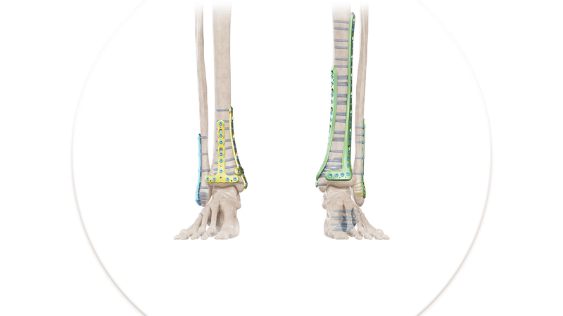 Foot & Ankle