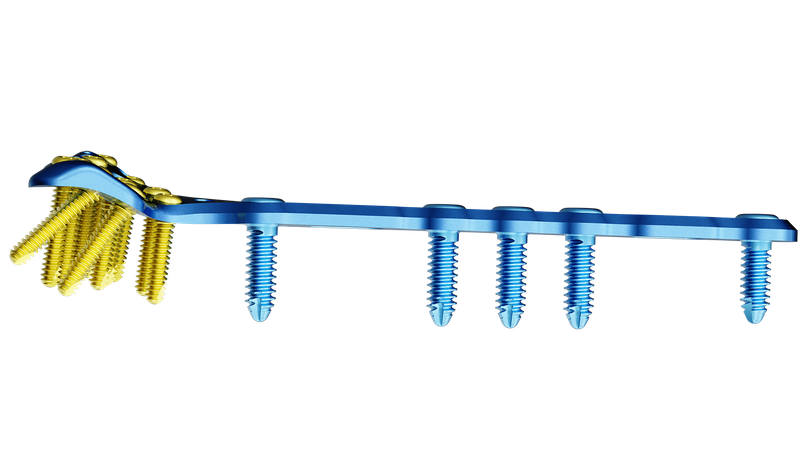 Distal Radyus Volar Anatomik Geniş Plak