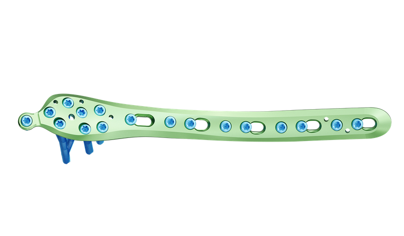 Distal Tibia Medyal Anatomik Plak