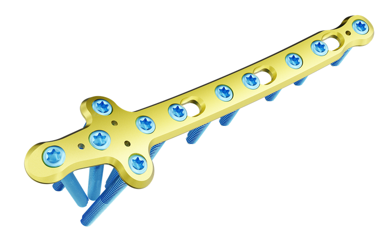 Distal Tibia Medyal Malleolar Plak