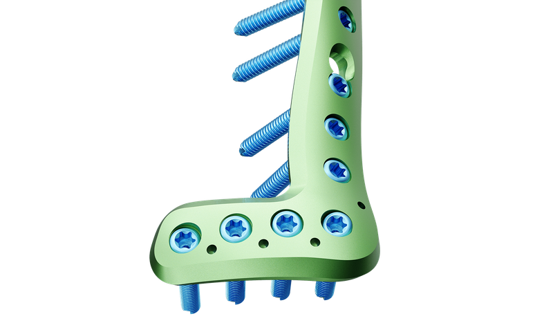 Distal Tibia Anterolateral Anatomik Plak