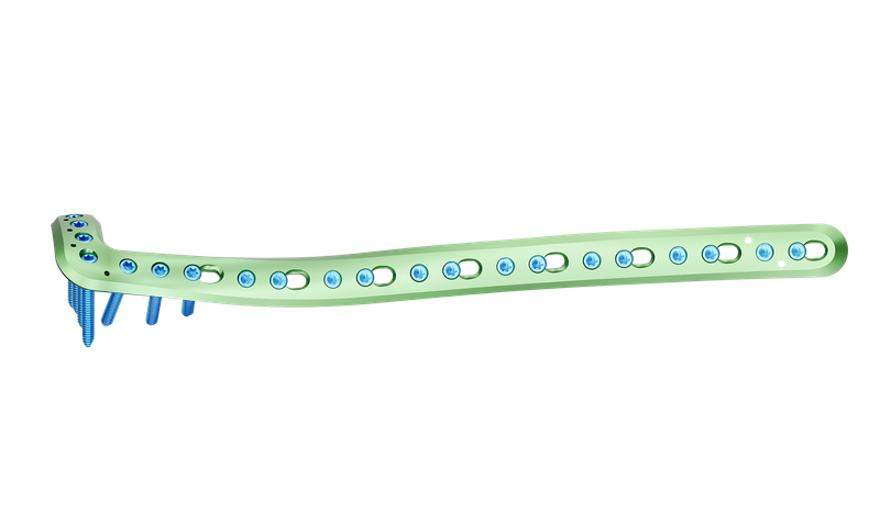 Distal Tibia Anterolateral Anatomik Plak