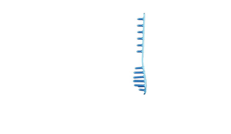 Distal Fibula Plak
