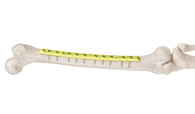 4.5 mm Femur Broad Straight Plate