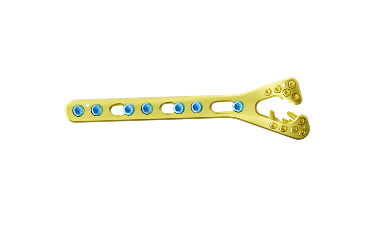 Distal Radyus Dorsal Anatomik Plak