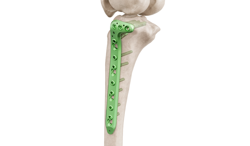 4.5 mm Proximal Tibia Lateral Anatomic Plate