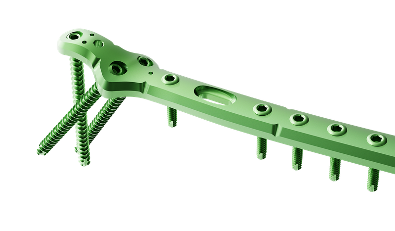 Proksimal Femur Lateral Anatomik Plak