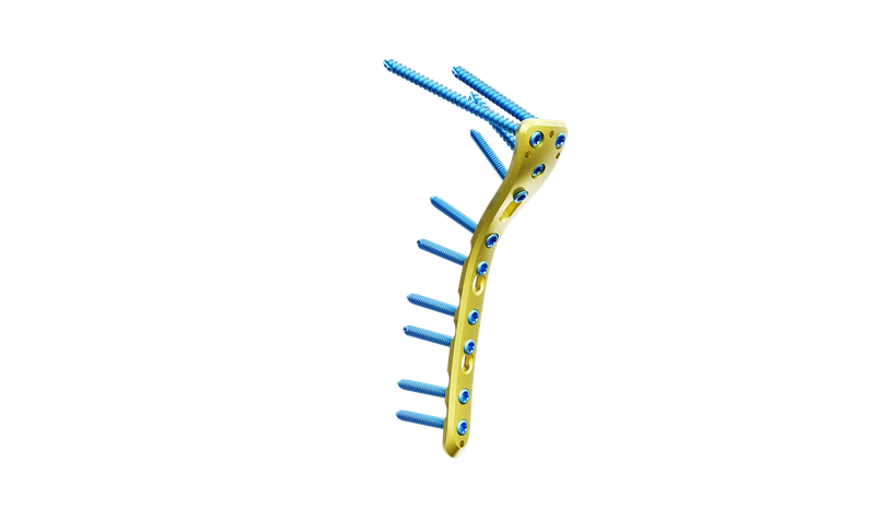 Proksimal Tibia Posteromedyal Plak