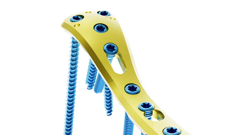 Proksimal Tibia Posteromedyal Plak