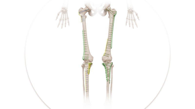 Tibia & Femur