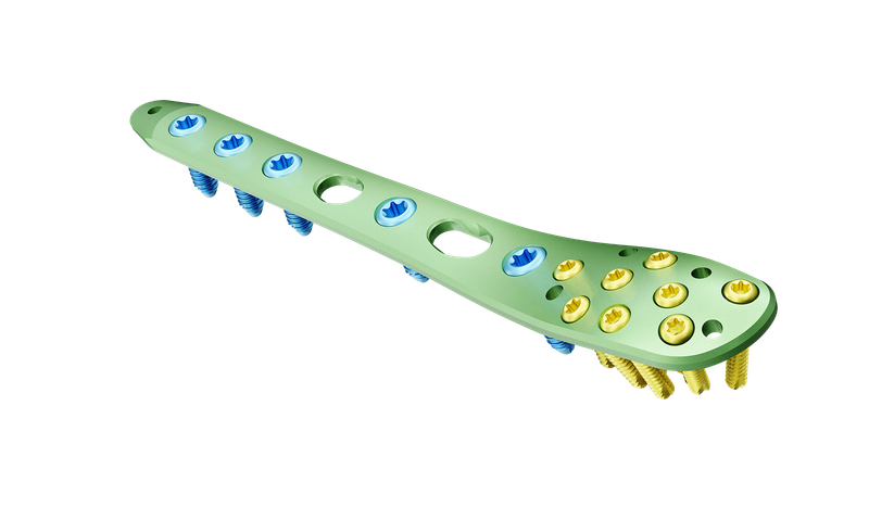 Distal Fibula Lateral Malleolar Anatomik Plak