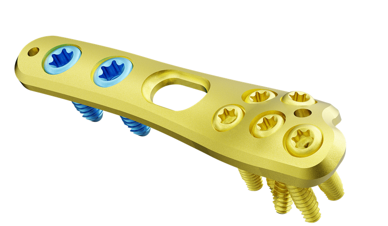 Distal Ulna Anatomik Plak