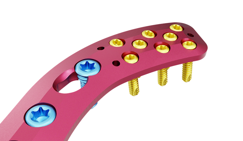 Superior Distal Clavicle Anatomic Plate